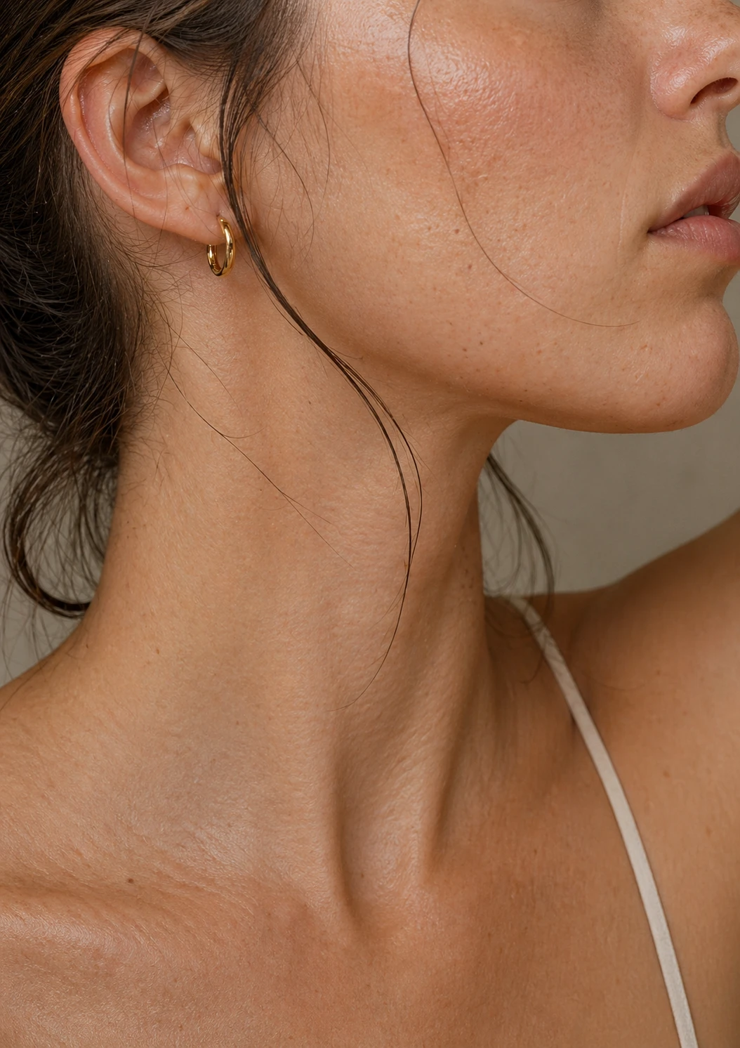 Skinbooster-resultat, illustrativt for Profhilo-behandling hos AKIDA
